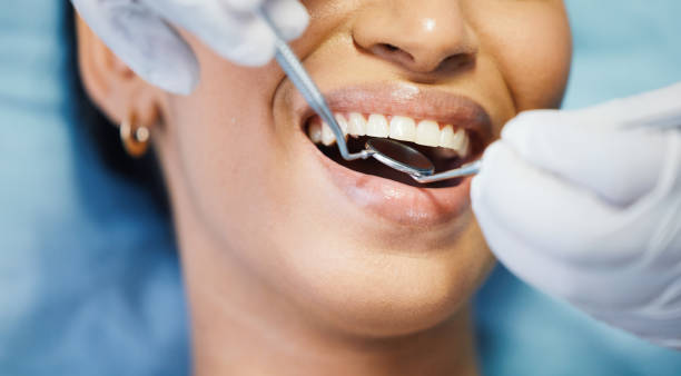 Best Emergency Tooth Extraction in New York, NY